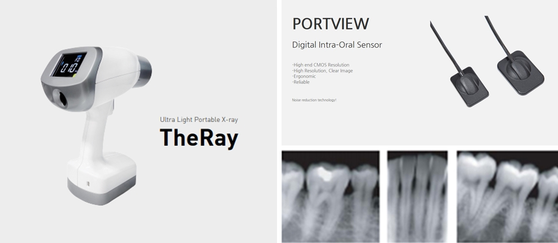 치과 X-ray & 디지털 오랄 센서